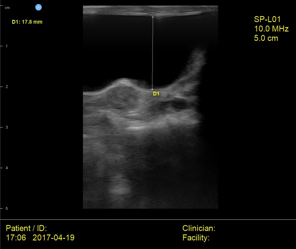 Interson Cat Bladder Ultrasound Image