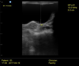 Interson Cat Bladder Ultrasound Image
