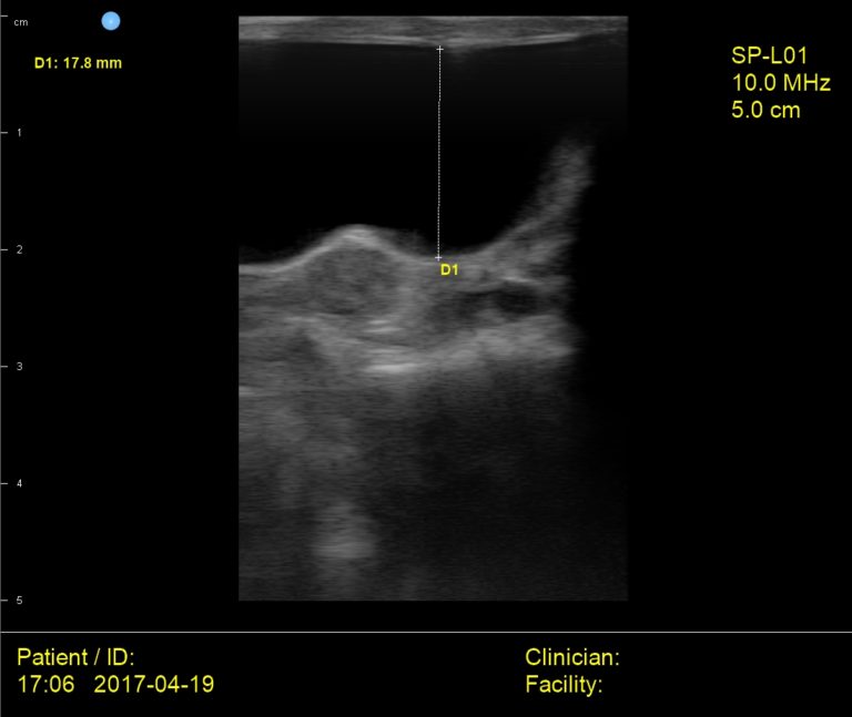 Interson Cat Bladder Ultrasound Image Interson Corporation