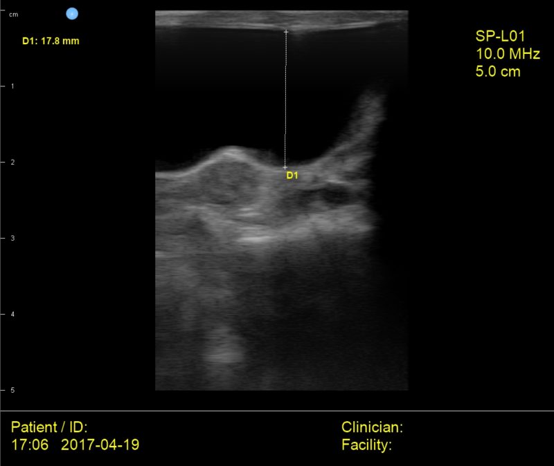 Interson Cat Bladder Ultrasound Image Interson Corporation