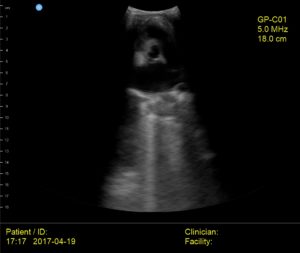 Interson Cat Heart Ultrasound Image