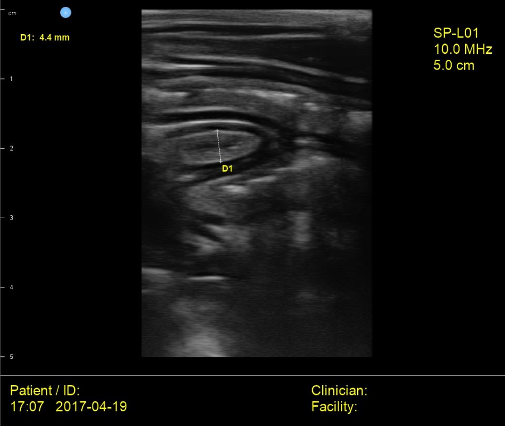 Interson Cat Intestine Ultrasound Image