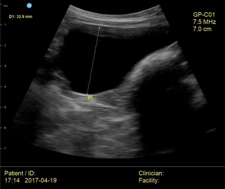 Interson Dog Bladder Ultrasound Image Interson Corporation