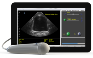 ViewBladder 10 with Screenshot