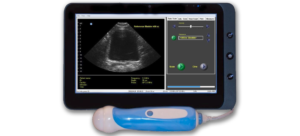 Viewbladder 10 Ultrasound Tablet