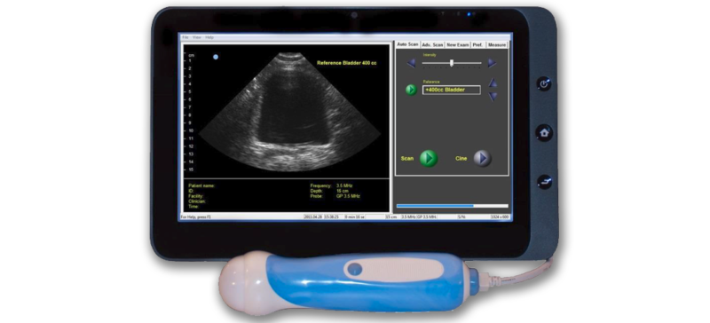 Interson Viewbladder 10 Ultrasound Tablet | Interson Corporation
