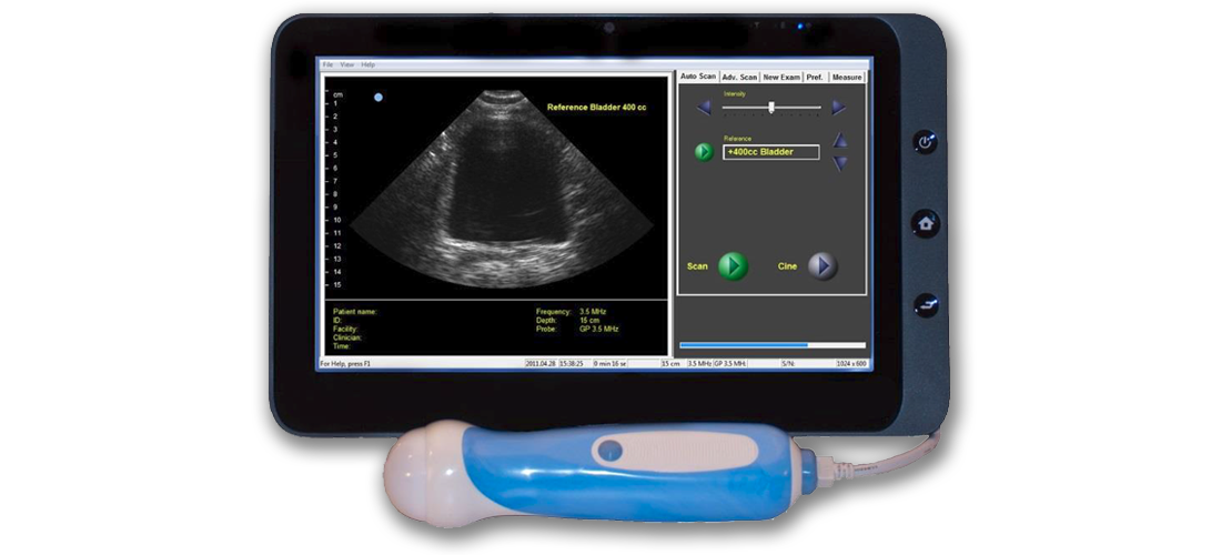 Viewbladder 10 Ultrasound Tablet Interson Corporation