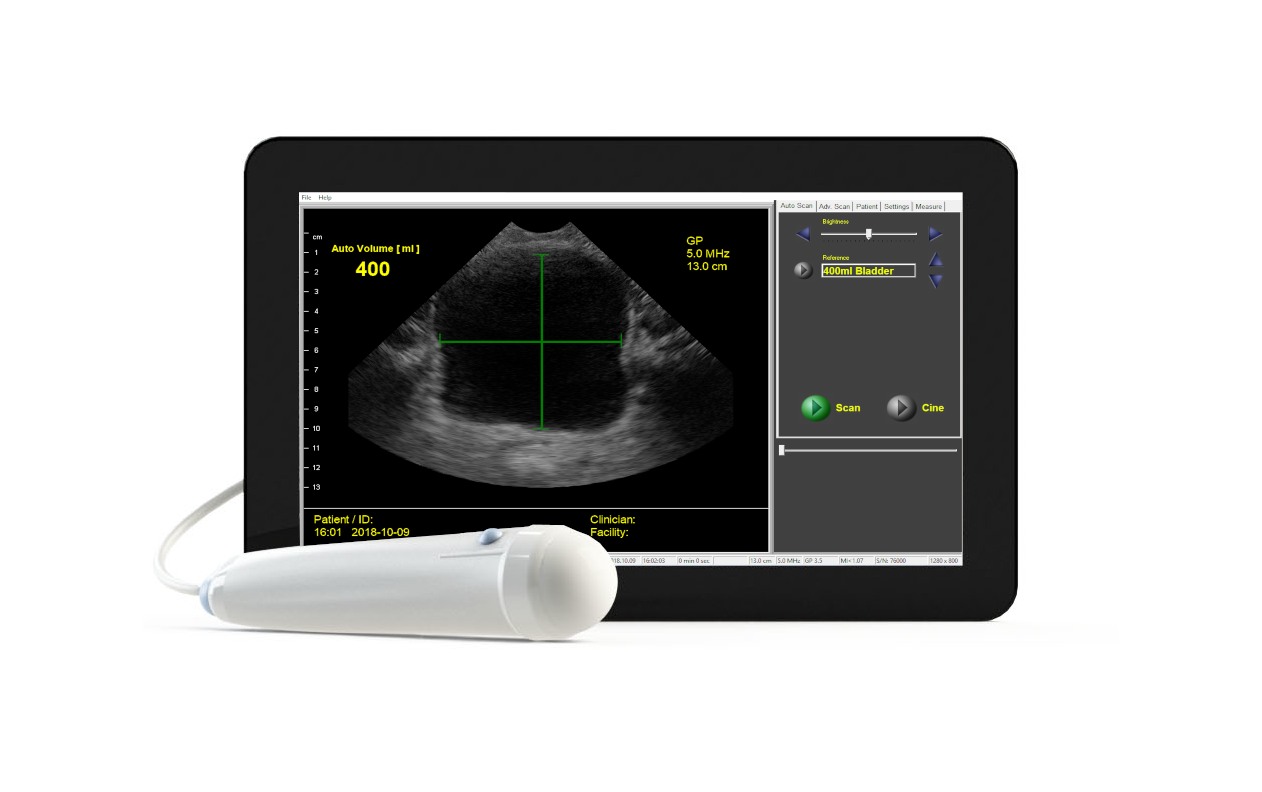 Viewbladder 10 Ultrasound Tablet