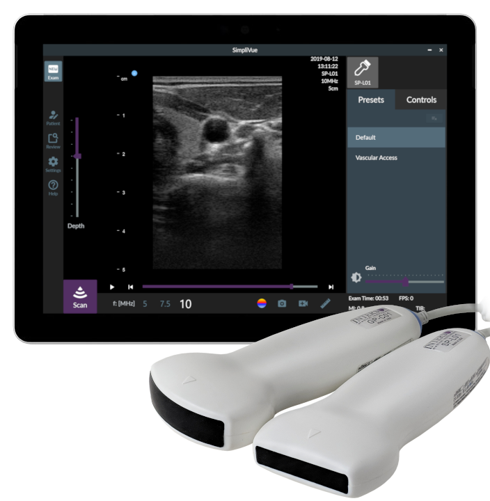 USB Ultrasound Probes for Physicians & Veterinarians: Interson